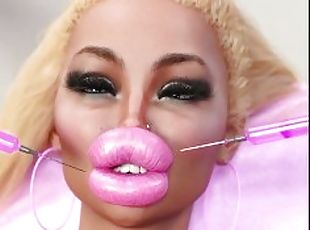 Porno Botox Lips