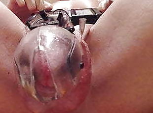Estim Cock Cage with 2 Needles in Balls